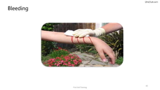 First aid safety ppt about how to do proper first aid treatment | PPTX