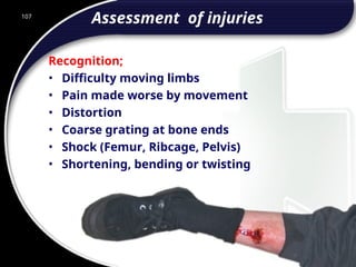 107
Assessment of injuries
Recognition;
• Difficulty moving limbs
• Pain made worse by movement
• Distortion
• Coarse grating at bone ends
• Shock (Femur, Ribcage, Pelvis)
• Shortening, bending or twisting
107
© 2002 Abertay Nationwide Training
 