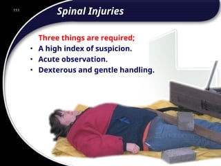 111
Spinal Injuries
Three things are required;
• A high index of suspicion.
• Acute observation.
• Dexterous and gentle handling.
111
© 2002 Abertay Nationwide Training
 