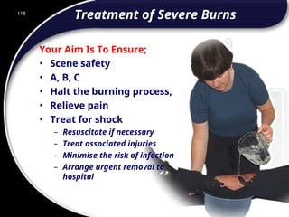 118
Treatment of Severe Burns
Your Aim Is To Ensure;
• Scene safety
• A, B, C
• Halt the burning process,
• Relieve pain
• Treat for shock
– Resuscitate if necessary
– Treat associated injuries
– Minimise the risk of infection
– Arrange urgent removal to
hospital
118
© 2002 Abertay Nationwide Training
 