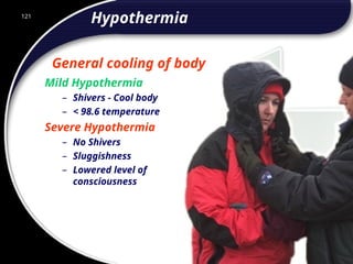 121
Hypothermia
General cooling of body
Mild Hypothermia
– Shivers - Cool body
– < 98.6 temperature
Severe Hypothermia
– No Shivers
– Sluggishness
– Lowered level of
consciousness
121
© 2002 Abertay Nationwide Training
 