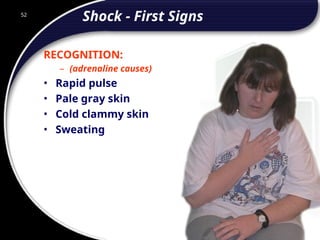 52
Shock - First Signs
RECOGNITION:
– (adrenaline causes)
• Rapid pulse
• Pale gray skin
• Cold clammy skin
• Sweating
52
© 2002 Abertay Nationwide Training
 