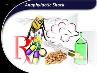 59
Anaphylactic Shock
59
© 2002 Abertay Nationwide Training
 