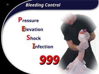 74
Bleeding Control
E
Elevation
Shock
I
Infection
Pressure
999
999
74
© 2002 Abertay Nationwide Training
 