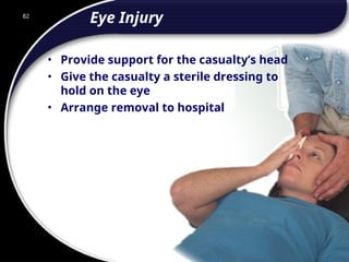 82
Eye Injury
• Provide support for the casualty’s head
• Give the casualty a sterile dressing to
hold on the eye
• Arrange removal to hospital
82
© 2002 Abertay Nationwide Training
 