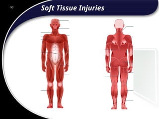 90
Soft Tissue Injuries
 