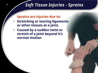 91
Soft Tissue Injuries - Sprains
Sprains are injuries due to:
• Stretching or tearing ligaments
or other tissues at a joint.
• Caused by a sudden twist or
stretch of a joint beyond it’s
normal motion
91
© 2002 Abertay Nationwide Training
 