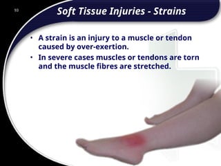 93
Soft Tissue Injuries - Strains
• A strain is an injury to a muscle or tendon
caused by over-exertion.
• In severe cases muscles or tendons are torn
and the muscle fibres are stretched.
93
© 2002 Abertay Nationwide Training
 