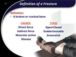 98
CAUSES:
Direct force
Indirect force
Muscular action
Disease
TYPES
Open/Closed
Stable/Unstable
Greenstick
Definition of a Fracture
Definition;
• A broken or cracked bone
98
© 2002 Abertay Nationwide Training
 