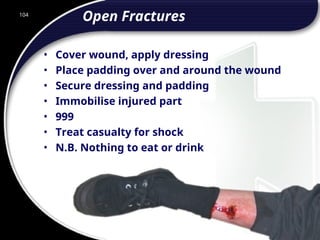 104
Open Fractures
• Cover wound, apply dressing
• Place padding over and around the wound
• Secure dressing and padding
• Immobilise injured part
• 999
• Treat casualty for shock
• N.B. Nothing to eat or drink
104
© 2002 Abertay Nationwide Training
 