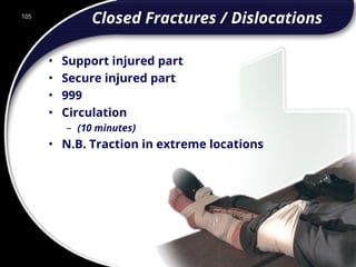 105
Closed Fractures / Dislocations
• Support injured part
• Secure injured part
• 999
• Circulation
– (10 minutes)
• N.B. Traction in extreme locations
105
© 2002 Abertay Nationwide Training
 