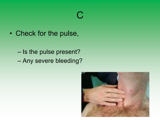 C
• Check for the pulse,
– Is the pulse present?
– Any severe bleeding?
 