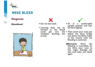 NOSE BLEED
Diagnosis
Nosebleed • Do not lean back.
• Learning back can be
harmful as the blood
could get into the
windpipe, blocking the
airway.
• Sit in a comfortable
upright position and lean
forward slightly.
• Then pinch your nose just
below the bony bridge
and above the fleshy lobes
of the nostrils until the
bleeding is stemmed.
Aftercare: Once the
bleeding is controlled, do
not blow your nose as
this might dislodge the
clot and make you bleed
again.
 