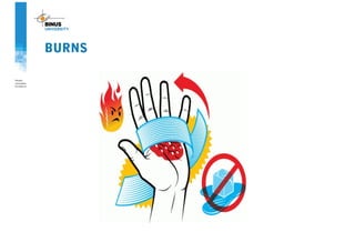 BURNS
 
