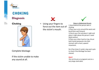 CHOKING
Diagnosis
Choking
Complete blockage
If the victim unable to make
any sound at all.
• Using your fingers to
force out the item out of
the victim’s mouth.
Steps in Abdominal thrusts
1.Stand behind the person who is
choking.
2.Place your arms around the waist and
bend them well forward.
3.Clench your fist and place it right and
place it right above the person’s navel
(belly button)
4.Place your other hand on top, thrust
both hands backwards into their
stomach with a hard, upward
movement.
Do it five times (1 cycle), stop each cycle
to check if the blockage has been
cleared.
Alert!
•Do not thrusts on pregnant and on a
very large sized adult.
 