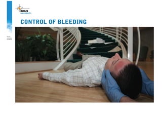 CONTROL OF BLEEDING
 