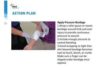 ACTION PLAN
Apply Pressure Bandage
1.Wrap a roller gauze or elastic
bandage around limb and over
injury to provide continuous
pressure to wound.
2.Include enough pressure to
control bleeding.
3.Avoid wrapping so tight that
skin beyond bandage becomes
cool to touch, bluish, or numb.
Make sure a finger can be
slipped under bandage once
applied.
 