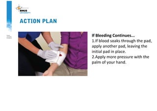 ACTION PLAN
If Bleeding Continues...
1.If blood soaks through the pad,
apply another pad, leaving the
initial pad in place.
2.Apply more pressure with the
palm of your hand.
 