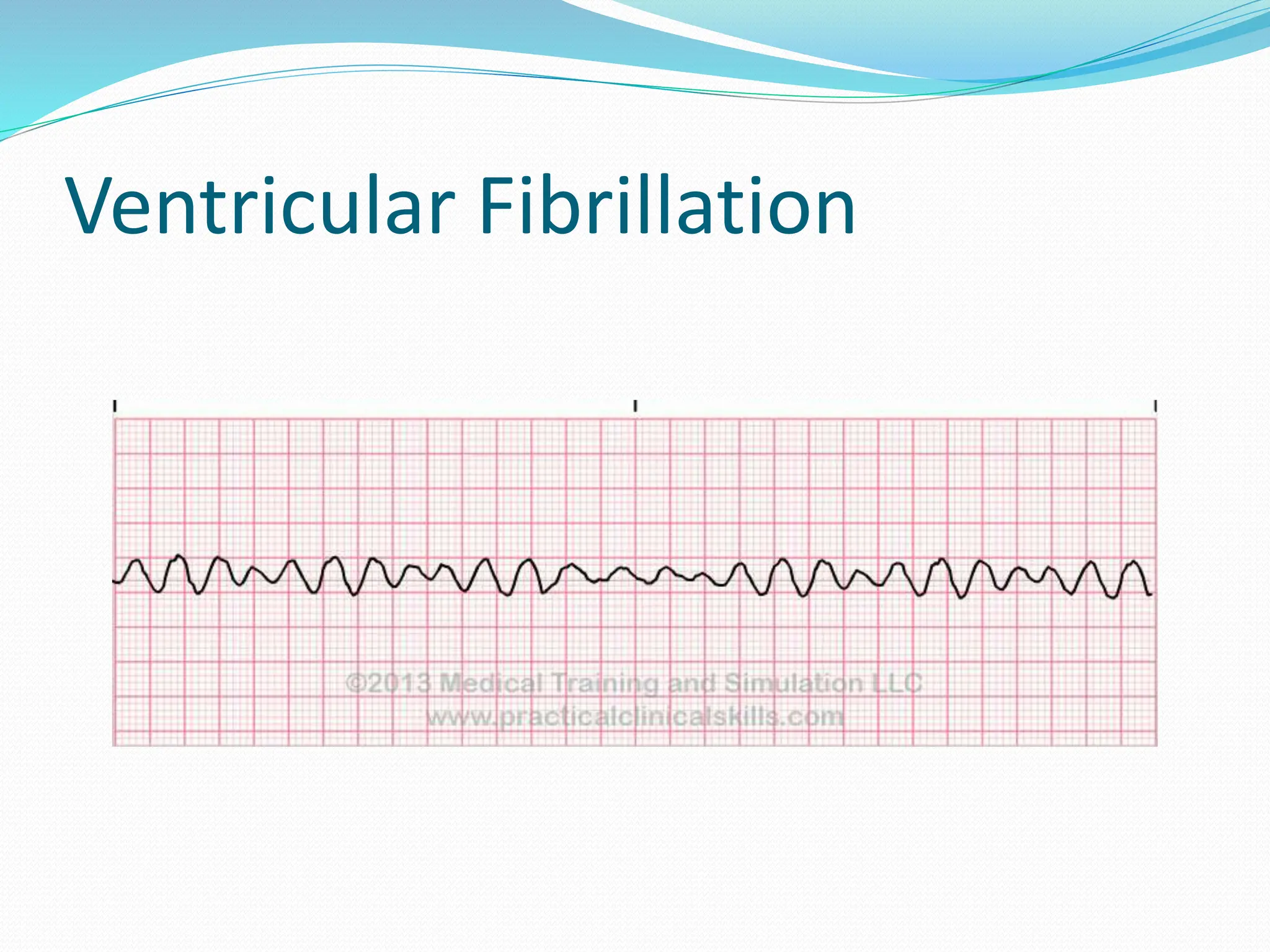 First Aid BLS & ACLS slidesEnglish.pptx
