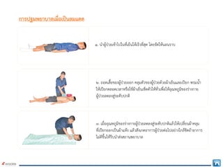 การปฐมพยาบาลเมื่อเปนลมแดด
๒. ถอดเสื้อของผูปวยออก คลุมตัวของผูปวยดวยผาเย็นและเปยก พรมน้ํา
ใหเปยกตลอดเวลาหรือใชผาเย็นเช็ดตัวใหทั่วเพื่อใหอุณหภูมิของรางกาย
ผูปวยลดลงสูระดับปกติ
๑. นําผูปวยเขาไปในที่เย็นใหเร็วที่สุด โดยจัดใหนอนราบ
๓. เมื่ออุณหภูมิของรางกายผูปวยลดลงสูระดับปกติแลวใหเปลี่ยนผาคลุม
ที่เปยกออกเปนผาแหง แลวสังเกตอาการผูปวยตอไปอยางใกลชิดถาอาการ
ไมดีขึ้นใหรีบนําสงสถานพยาบาล
 