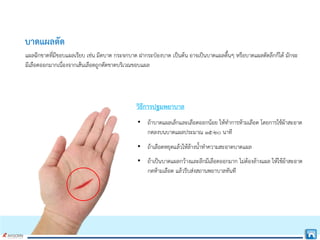 บาดแผลตัด
แผลฉีกขาดที่มีขอบแผลเรียบ เชน มีดบาด กระจกบาด ฝากระปองบาด เปนตน อาจเปนบาดแผลตื้นๆ หรือบาดแผลตัดลึกก็ได มักจะ
มีเลือดออกมากเนื่องจากเสนเลือดถูกตัดขาดบริเวณขอบแผล
วิธีการปฐมพยาบาล
• ถาบาดแผลเล็กและเลือดออกนอย ใหทําการหามเลือด โดยการใชผาสะอาด
กดลงบนบาดแผลประมาณ ๑๕-๒๐ นาที
• ถาเลือดหยุดแลวใหลางน้ําทําความสะอาดบาดแผล
• ถาเปนบาดแผลกวางและลึกมีเลือดออกมาก ไมตองลางแผล ใหใชผาสะอาด
กดหามเลือด แลวรีบสงสถานพยาบาลทันที
 