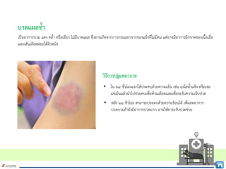 บาดแผลช้ํา
เปนอาการบวม แดง คล้ํา หรือเขียว ไมมีบาดแผล ซึ่งอาจเกิดจากการกระแทกจากของแข็งที่ไมมีคม แตอาจมีอาการฉีกขาดของเนื้อเยื่อ
และเสนเลือดฝอยใตผิวหนัง
วิธีการปฐมพยาบาล
• ใน ๒๔ ชั่วโมงแรกใหประคบดวยความเย็น เชน ถุงใสน้ําแข็ง หรือเจล
แชเย็นแลวนําไปประคบเพื่อหามเลือดและเพื่อระงับความเจ็บปวด
• หลัง ๒๔ ชั่วโมง สามารถประคบดวยความรอนได เพื่อลดอาการ
ปวดบวมถายังมีอาการปวดมาก อาจใหยาระงับปวดชวย
 