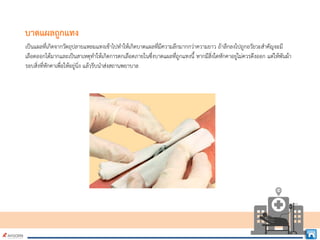 บาดแผลถูกแทง
เปนแผลที่เกิดจากวัตถุปลายแหลมแทงเขาไปทําใหเกิดบาดแผลที่มีความลึกมากกวาความยาว ถาลึกลงไปถูกอวัยวะสําคัญจะมี
เลือดออกไดมากและเปนสาเหตุทําใหเกิดการตกเลือดภายในซึ่งบาดแผลที่ถูกแทงนี้ หากมีสิ่งใดหักคาอยูไมควรดึงออก แตใหพันผา
รอบสิ่งที่หักคาเพื่อใหอยูนิ่ง แลวรีบนําสงสถานพยาบาล
 