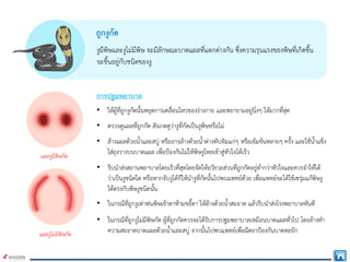 ถูกงูกัด
งูมีพิษและงูไมมีพิษ จะมีลักษณะบาดแผลที่แตกตางกัน ซึ่งความรุนแรงของพิษที่เกิดขึ้น
จะขึ้นอยูกับชนิดของงู
• ใหผูที่ถูกงูกัดนั้นหยุดการเคลื่อนไหวของรางกาย และพยายามอยูนิ่งๆ ใหมากที่สุด
• ตรวจดูแผลที่ถูกกัด สังเกตดูวางูที่กัดเปนงูพิษหรือไม
• ลางแผลดวยน้ําและสบู หรืออาจลางดวยน้ําดางทับทิมแกๆ หรือเขมขนหลายๆ ครั้ง และใชน้ําแข็ง
ใสถุงวางบนบาดแผล เพื่อปองกันไมใหพิษงูไหลเขาสูหัวใจไดเร็ว
การปฐมพยาบาล
• รีบนําสงสถานพยาบาลโดยเร็วที่สุดโดยจัดใหอวัยวะสวนที่ถูกกัดอยูต่ํากวาหัวใจและควรจําใหได
วาเปนงูชนิดใด หรือหากจับงูไดก็ใหนํางูที่กัดนั้นไปพบแพทยดวย เพื่อแพทยจะไดใชเซรุมแกพิษงู
ไดตรงกับพิษงูชนิดนั้น
• ในกรณีที่ถูกงูเหาพนพิษเขาตาหามขยี้ตา ใหลางดวยน้ําสะอาด แลวรีบนําสงโรงพยาบาลทันที
• ในกรณีที่ถูกงูไมมีพิษกัด ผูที่ถูกกัดควรจะไดรับการปฐมพยาบาลเหมือนบาดแผลทั่วไป โดยลางทํา
ความสะอาดบาดแผลดวยน้ําและสบู จากนั้นไปพบแพทยเพื่อฉีดยาปองกันบาดทะยัก
แผลงูมีพิษกัด
แผลงูไมมีพิษกัด
 