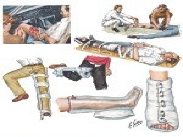 First Aid For Broken Bones Training – XVYP