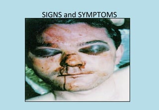 SIGNS and SYMPTOMS
 