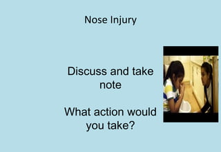 Nose Injury
Discuss and take
note
What action would
you take?
 