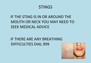 STINGS
IF THE STING IS IN OR AROUND THE
MOUTH OR NECK YOU MAY NEED TO
SEEK MEDICAL ADVICE
IF THERE ARE ANY BREATHING
DIFFICULTIES DIAL 999
 