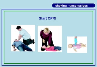 choking - unconscious
Start CPR!
 