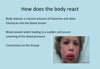How does the body react
Body releases a massive amount of histamine and other
Chemicals into the blood stream
Blood vessels widen leading to a sudden and severe
Lowering of the blood pressure.
Constriction on the Airway
 