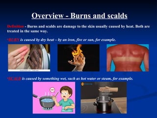 Comprehensive First Aid Guide to Burns and Scalds: Types, Treatment ...