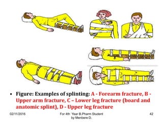 • Figure: Examples of splinting: A - Forearm fracture, B -
Upper arm fracture, C – Lower leg fracture (board and
anatomic splint), D - Upper leg fracture
02/11/2016 For 4th Year B.Pharm Student
by Menbere D.
42
 