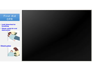 First Aid
CPR
First Aid
CPR
• Look listen-feel for
breathing
• Check cavity for oral
obstruction
Attempt to Ventilate
Establish responsiveness
Recovery position
Use chin lift/head tilt30 Compressions
To 2 Breaths
• Ask are you OK?
• Call 911
Check pulse
- First or recurrent heart attack 1.25
million
- 70% deaths from heart attack occur
before victim reaches hospital
- Strokes 3rd leading cause to death.
Cardio Pulmonary Resuscitation
 