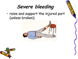 Severe bleeding raise and support the injured part (unless broken); 