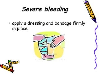 Severe bleeding apply a dressing and bandage firmly in place. 