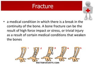 Fracture
• a medical condition in which there is a break in the
continuity of the bone. A bone fracture can be the
result of high force impact or stress, or trivial injury
as a result of certain medical conditions that weaken
the bones
 