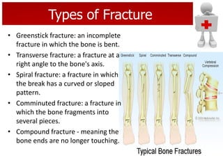 Types of Fracture
• Greenstick fracture: an incomplete
fracture in which the bone is bent.
• Transverse fracture: a fracture at a
right angle to the bone's axis.
• Spiral fracture: a fracture in which
the break has a curved or sloped
pattern.
• Comminuted fracture: a fracture in
which the bone fragments into
several pieces.
• Compound fracture - meaning the
bone ends are no longer touching.
 