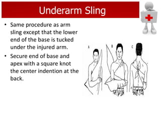 Underarm Sling
• Same procedure as arm
sling except that the lower
end of the base is tucked
under the injured arm.
• Secure end of base and
apex with a square knot
the center indention at the
back.
 