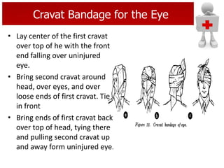 Cravat Bandage for the Eye
• Lay center of the first cravat
over top of he with the front
end falling over uninjured
eye.
• Bring second cravat around
head, over eyes, and over
loose ends of first cravat. Tie
in front
• Bring ends of first cravat back
over top of head, tying there
and pulling second cravat up
and away form uninjured eye.
 