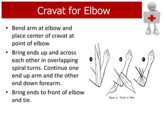 Cravat for Elbow
• Bend arm at elbow and
place center of cravat at
point of elbow
• Bring ends up and across
each other in overlapping
spiral turns. Continue one
end up arm and the other
end down forearm.
• Bring ends to front of elbow
and tie.
 