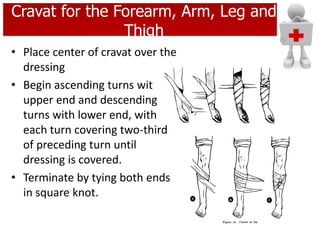 Cravat for the Forearm, Arm, Leg and
Thigh
• Place center of cravat over the
dressing
• Begin ascending turns wit
upper end and descending
turns with lower end, with
each turn covering two-third
of preceding turn until
dressing is covered.
• Terminate by tying both ends
in square knot.
 