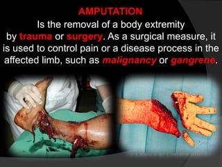 Define Mutilation First Aid & Basic Life Support japz.pptx