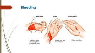 Bleeding
 