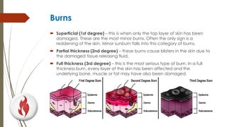 Burns
 Superficial (1st degree) – this is when only the top layer of skin has been
damaged. These are the most minor burns. Often the only sign is a
reddening of the skin. Minor sunburn falls into this category of burns.
 Partial thickness (2nd degree) – these burns cause blisters in the skin due to
the damaged tissue releasing fluid.
 Full thickness (3rd degree) – this is the most serious type of burn. In a full
thickness burn, every layer of the skin has been affected and the
underlying bone, muscle or fat may have also been damaged.
 