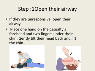 Step :1Open their airway
• If they are unresponsive, open their
airway.
• Place one hand on the casualty’s
forehead and two fingers under their
chin. Gently tilt their head back and lift
the chin.
 