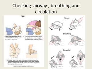 Checking airway , breathing and
circulation
 
